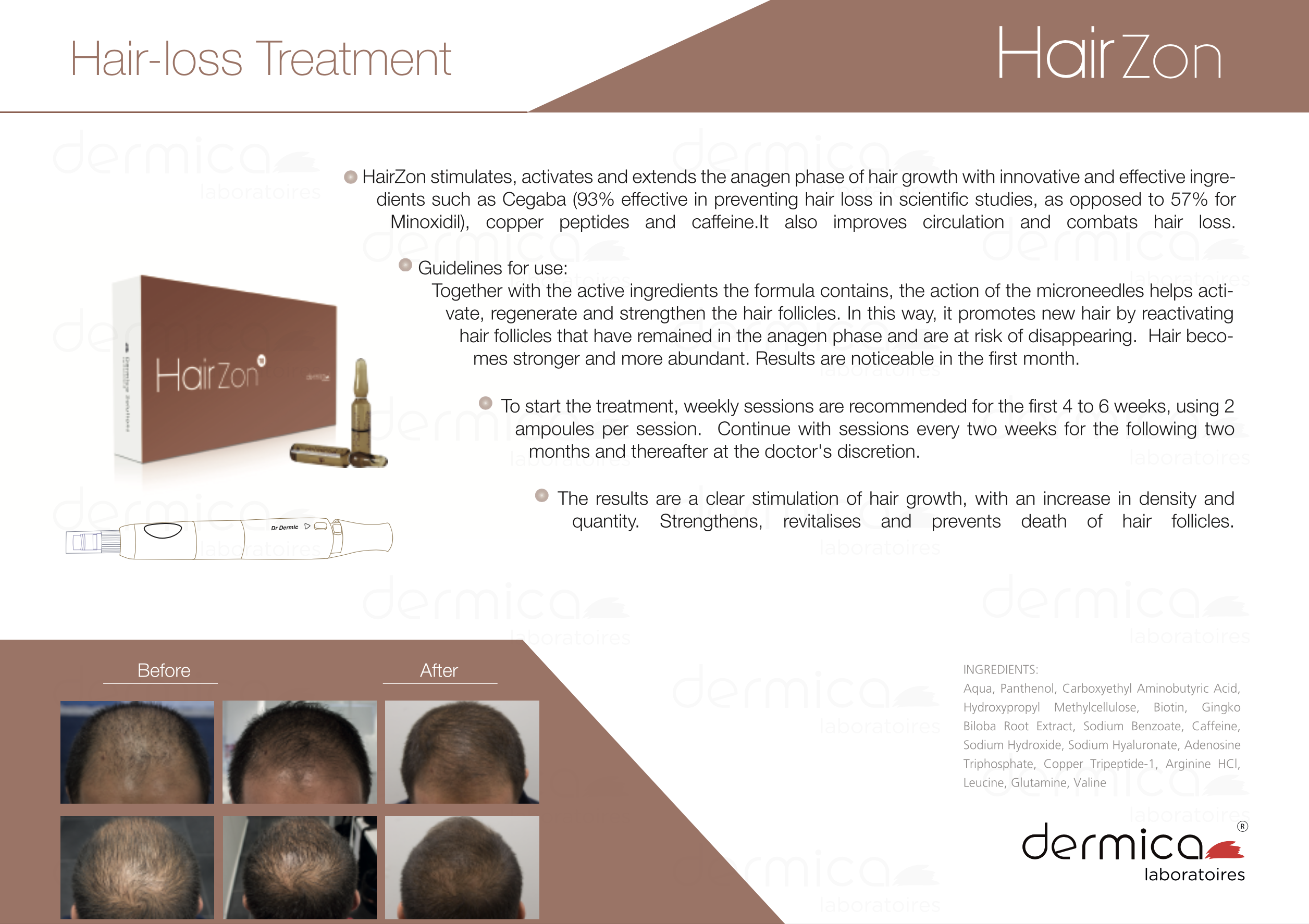 dermica hairzon protocole